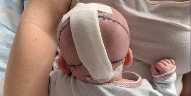 Полски специалисти направиха иновативна операция на момиче, което се роди
