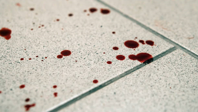 Болница шокира жена: Подът беше изцапан с кръв, мръсотия до шия в чакалнята
