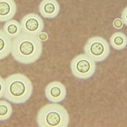 Учените дълго време изучават вида дрождеподобни гъбички Cryptococcus Cryptococcus neoformans