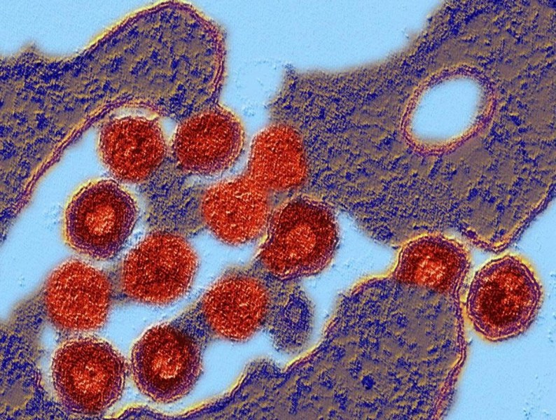 Учени откриха 13 древни смъртоносни вируса. За тях лекарства няма