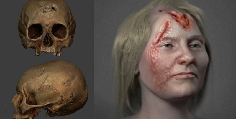 Жертва на сифилис. Създадоха възстановка на образа на жена, живяла преди 500 г.