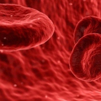 Пациенти с кръвни заболявания като сърповидно клетъчна анемия често се