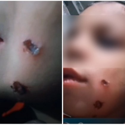 Видео с наранено невръстно дете в социалната мрежа ТикТок шокира