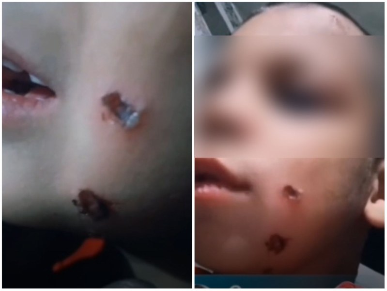 Зловещо видео на дете с прогорени бузи се върти из нета, баща му - кърджалийски тиктокър