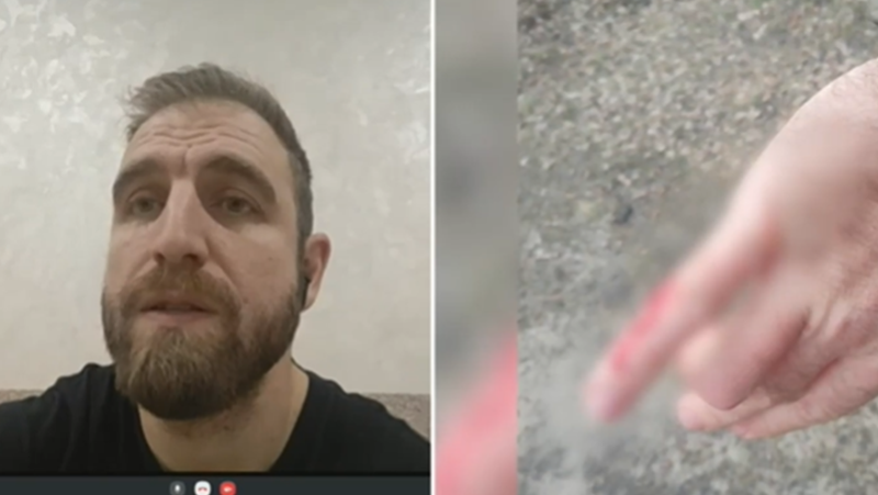 Пловдивчанин оцеля по чудо след обстрел в Украйна