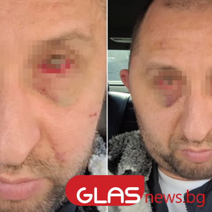 Мъж твърди че е станал жертва на полицейско насилие Емил Атанасов