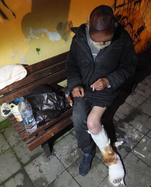 Добри хора помогнаха на бездомник с гипсиран крак СНИМКИ