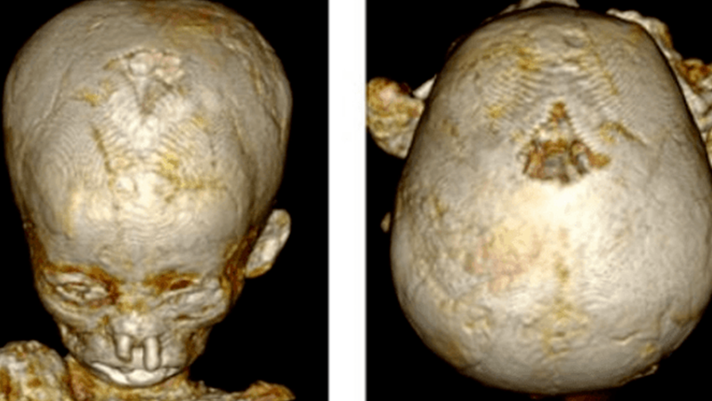 Мумиите на древноегипетски деца показват високи нива на анемия