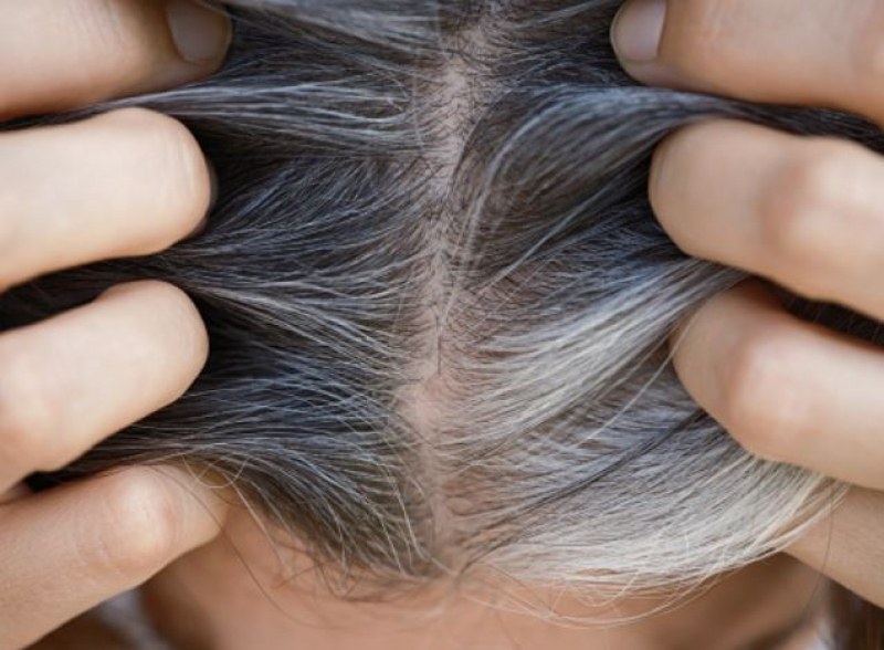 Последно проучване показва защо всъщност косата побелява
