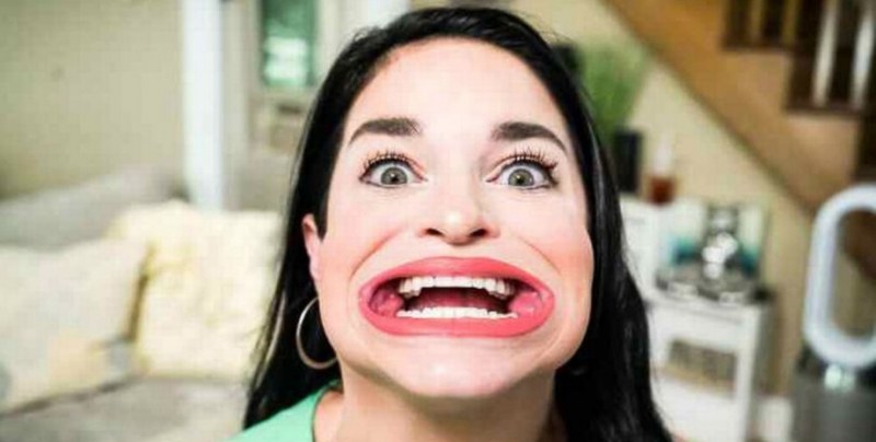 Нарекоха я жаба: американка твърди, че има най-голямата уста в света ВИДЕО