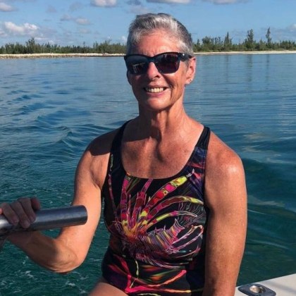 73 годишната туристка Хайди Ернст от САЩ е загубила крака си