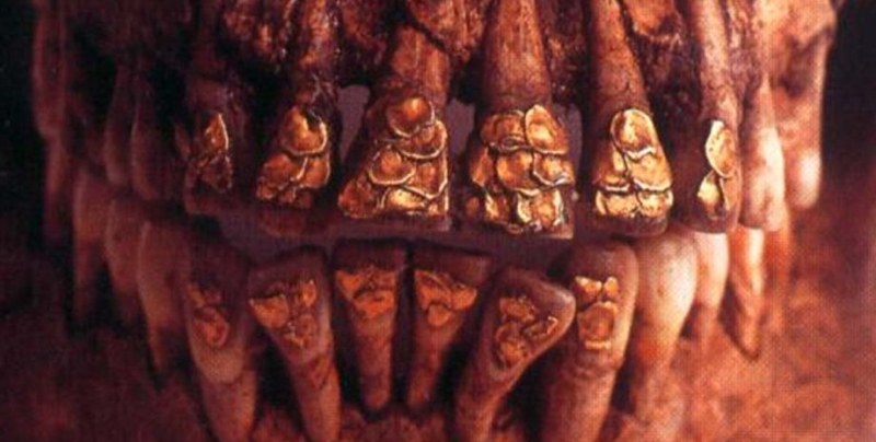 Древната стоматология е била скъпа: череп със златни зъби изуми всички СНИМКИ