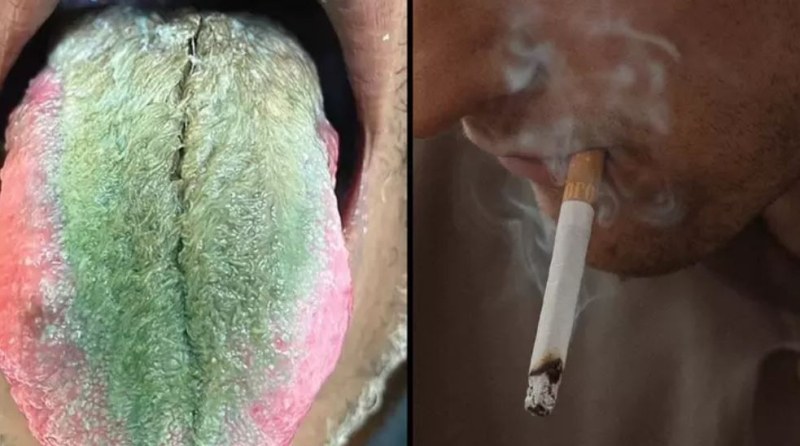 Езикът на пушач позеленя и се 