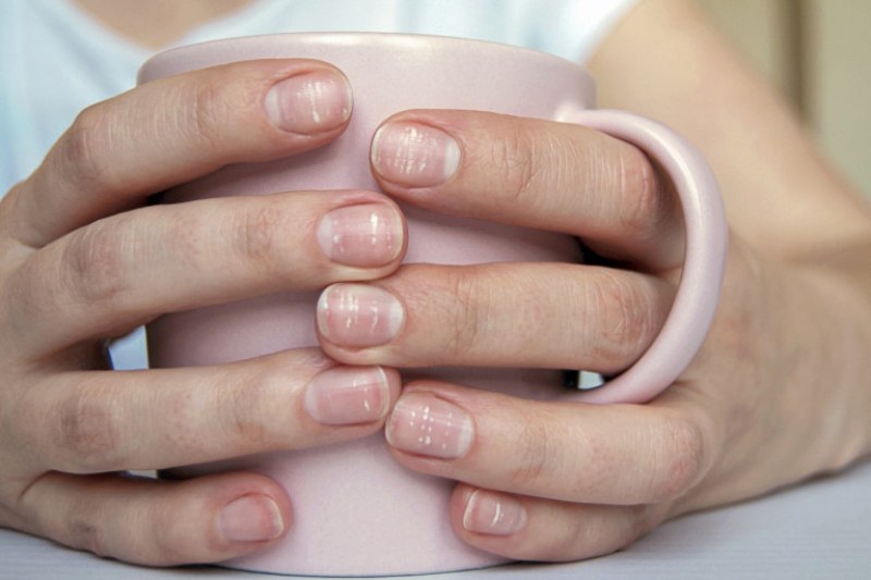 Наличието на бели петна върху ноктите е един от най-често