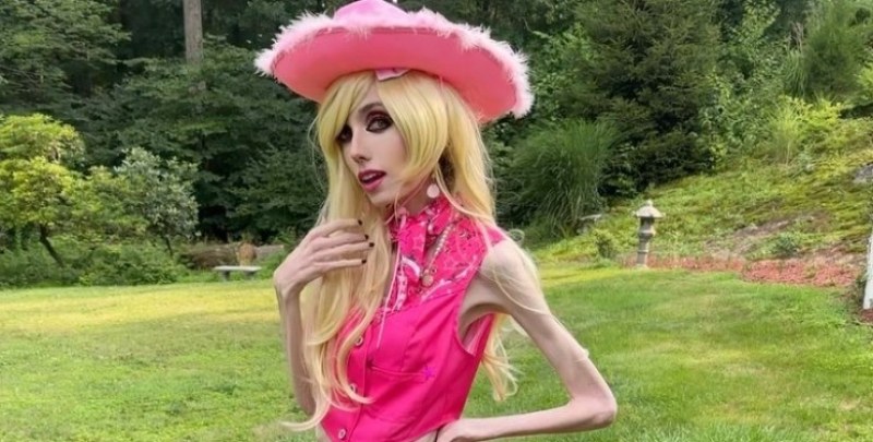 Блогърка с анорексия се облече като Барби. Как реагираха последователите й? ВИДЕО