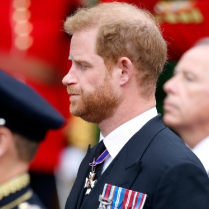 38 годишният принц Хари може да губи косата си поради стрес