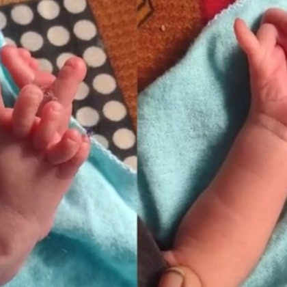 В Индия се е родило бебе със седем пръста на