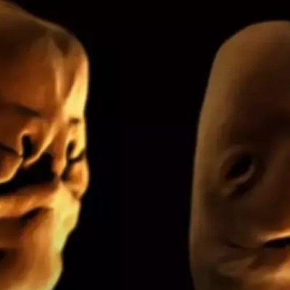 Страховита симулация показва как се развива лицето на бебето в