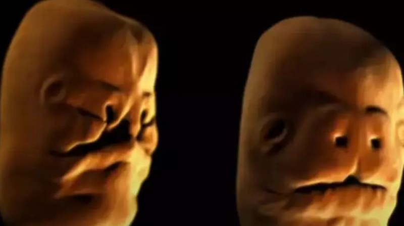 Страховита симулация, показва как се развива лицето на бебето в