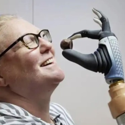 Група специалисти от цял ​​свят са разработили бионична ръка която