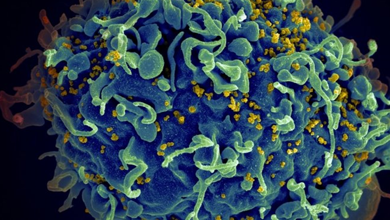 ХИВ болестта тайно продължава да се съпротивлява на лечението