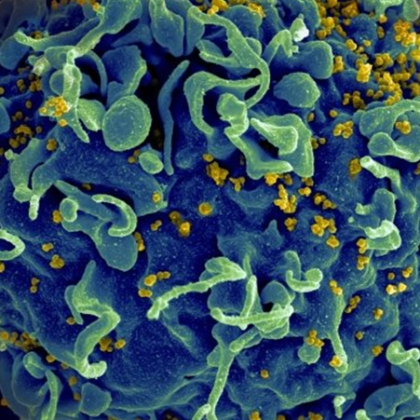 Учените вярват че ХИВ след лечение просто ще остане в