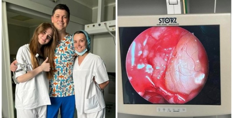 Млечният зъб на 23-годишно момче поникна на неочаквано място СНИМКИ