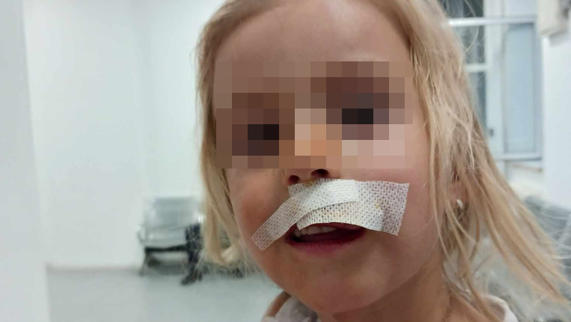 4-годишно дете пострада, след като бе нападнато от куче в Кюстендил СНИМКИ