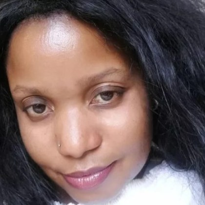 38 годишната Тобе Мойо от Кейптаун Южна Африка получи болезнени изгаряния