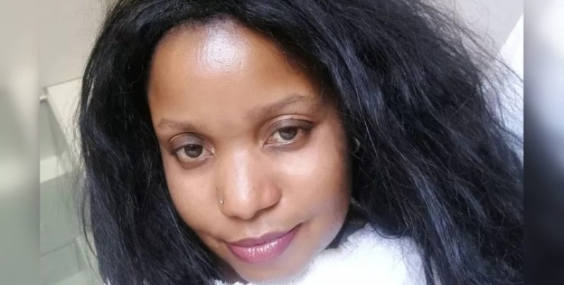 38-годишната Тобе Мойо от Кейптаун, Южна Африка, получи болезнени изгаряния,