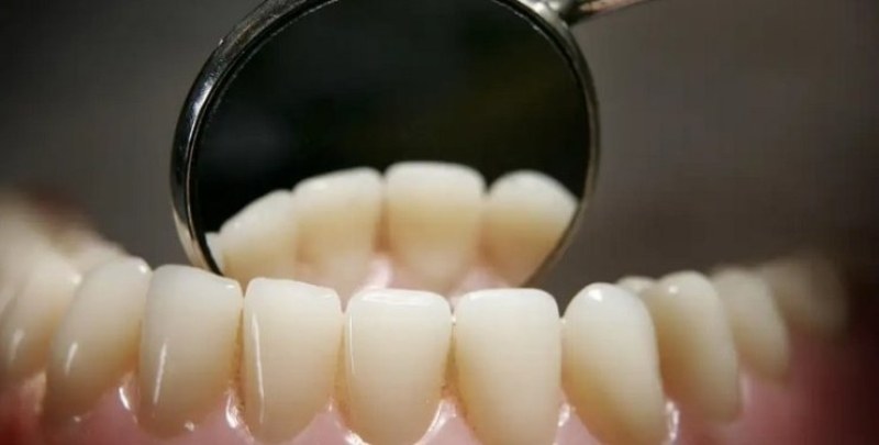 Жена с феноменален брой зъби влезе в Гинес СНИМКА