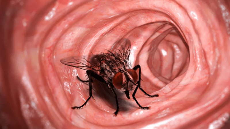 Откриха жива жужаща муха в стомаха на човек СНИМКА