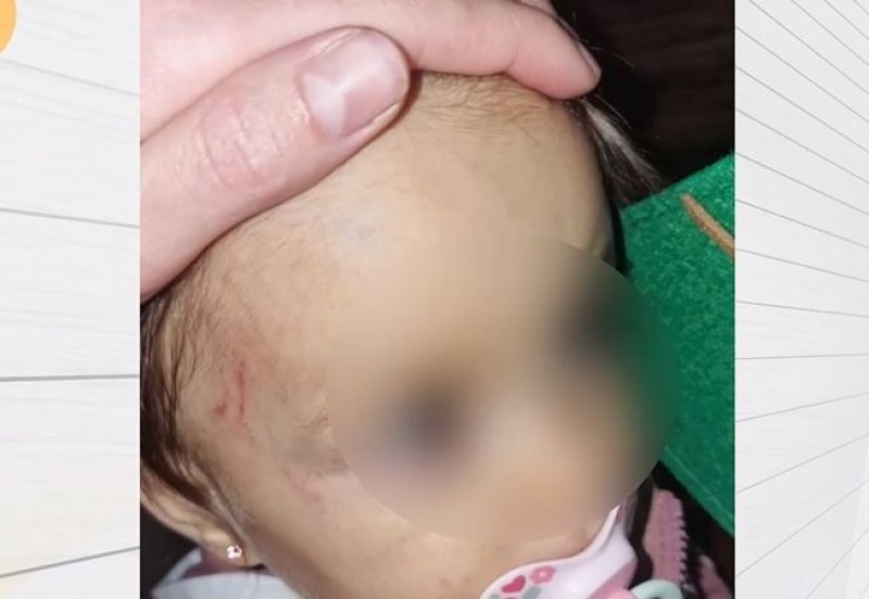 Дете на годинка пострада в частна занималня