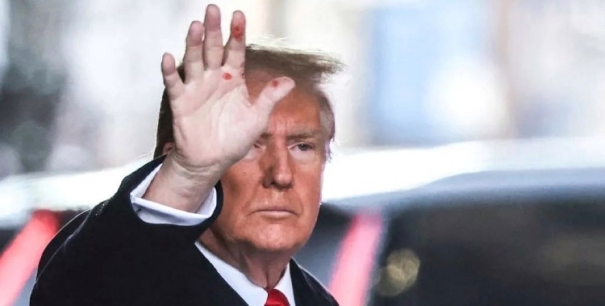 Сифилис, голф или изгаряне: какви са тези червени петна по ръката на Тръмп?