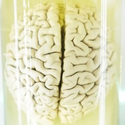 Мозъкът е много крехка и сложна структура – ​​от години учените