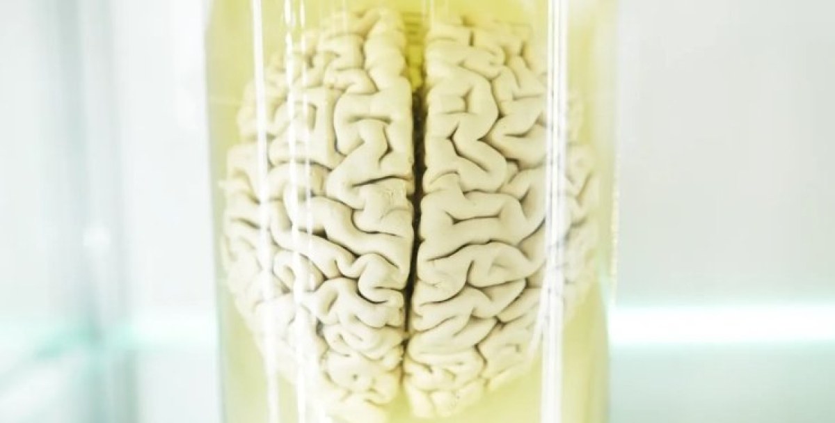 Мозък остана жив 5 часа извън тялото: как го направиха учените?