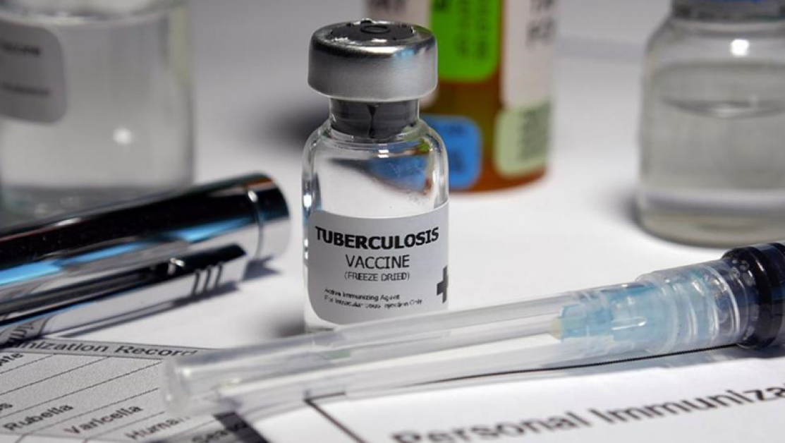 Учени от Холандия предупреждават за нов щам на туберкулоза, който