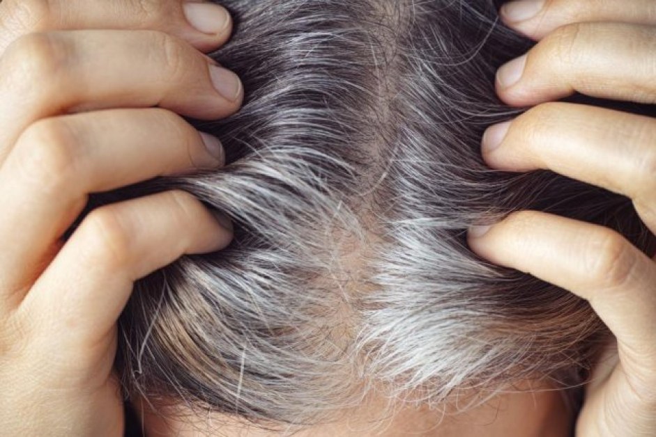 Учените казаха как да забавите побеляването на косата