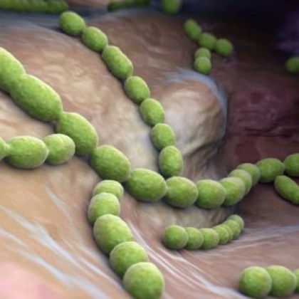 Рядка смъртоносна бактериална инфекция  разяждаща плътта се разпространява с рекордна скорост в