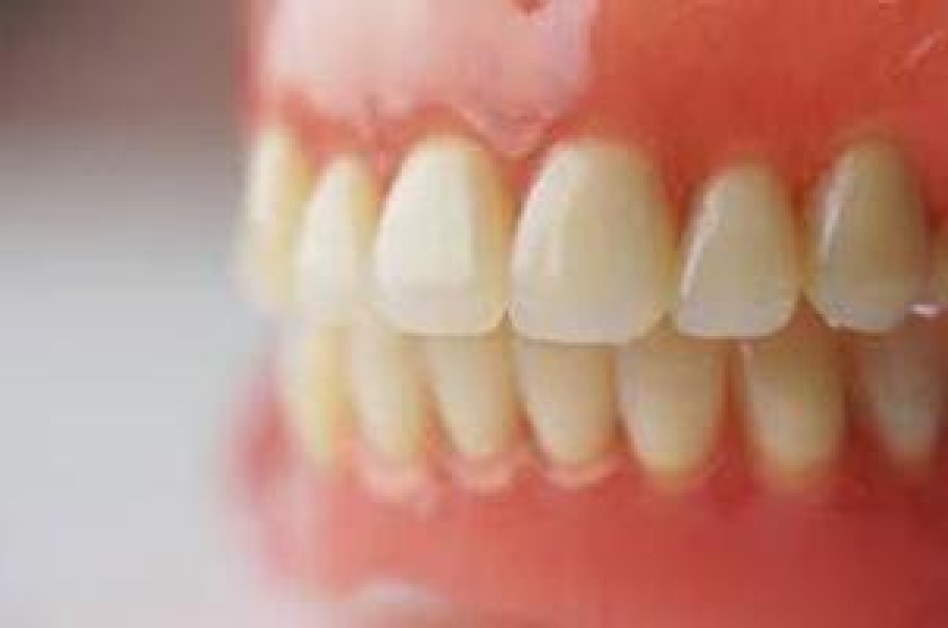 Плащането на зъбни протези от Здравната каса се отлага. То