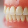 Отлага се плащането на зъбни протези от Здравната каса