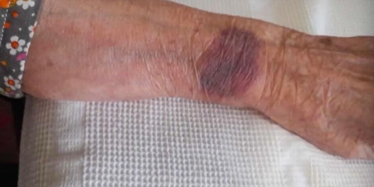 104-годишната жена, изписана от болница във Видин със синини, е