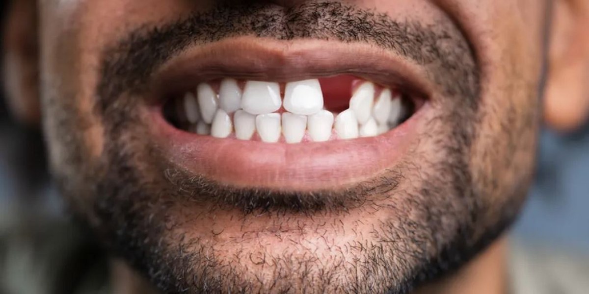 Лекарство, което възстановява зъбите, може да бъде на пазара до