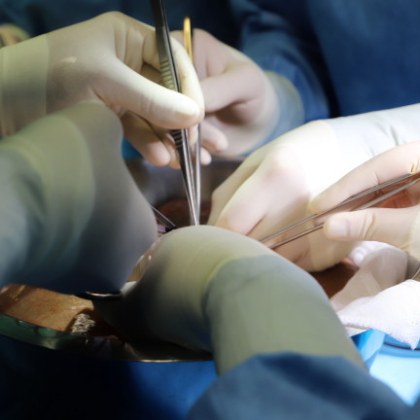 Тайни клиники във Филипините предлагат услуги по пластична хирургия на