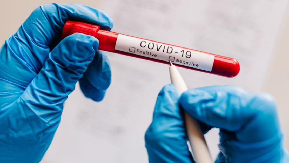 Повече от 40 спортисти са дали положителен тест за COVID-19 на Игрите в Париж