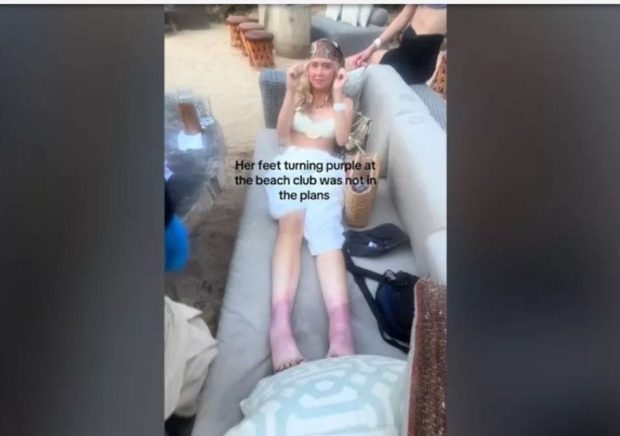Краката на младо момиче станаха лилави на плажа ВИДЕО