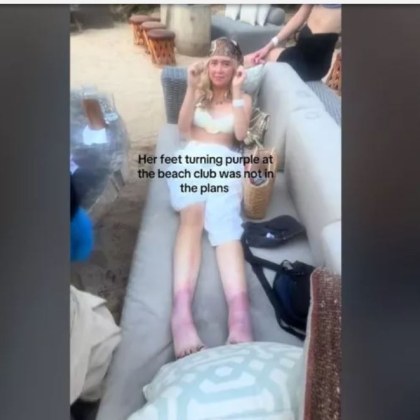 Видео показващо дамски крака които са в плашещ лилав нюанс