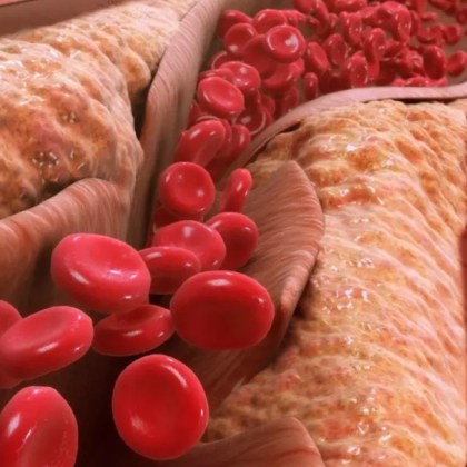 Вашият холестерол се отнася до мярка за два вида частици