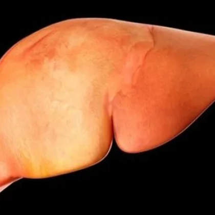 Появи се ново потенциално лечение за дефицит на лизозомна киселинна