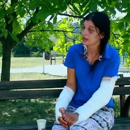 Жена е със счупени ръце и изваден яйчник след тричасов побой